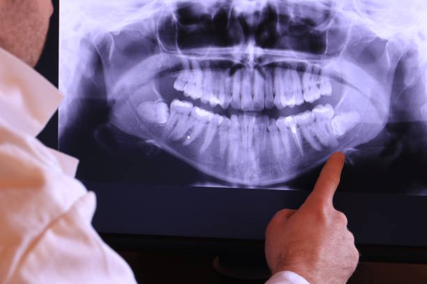 Best Emergency Dental Surgery in Point Of Rocks, MD