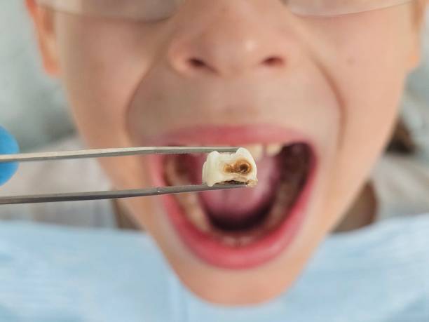 Best Emergency Treatment for Toothache in Point Of Rocks, MD