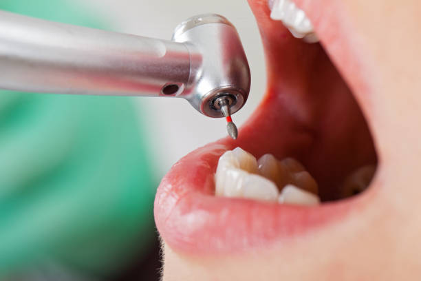 Best Emergency Wisdom Teeth Removal in Point Of Rocks, MD